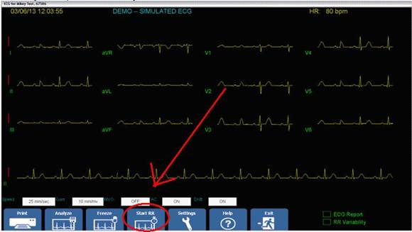 Midmark ECG RR Function